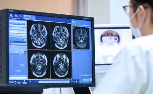 何らかの脳疾患が原因で起きる二次性てんかんにも対応
